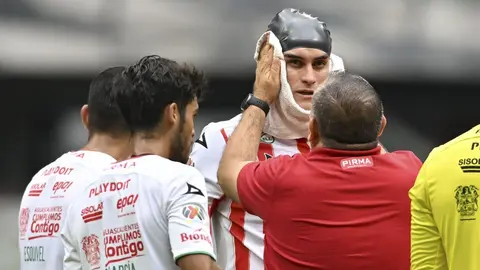 Necaxa: Las fotos de la vistosa herida de Alexis Peña en la cabeza