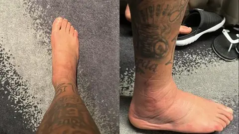 Qatar 2022: Neymar sorprendió con imagen de su tobillo inflamado