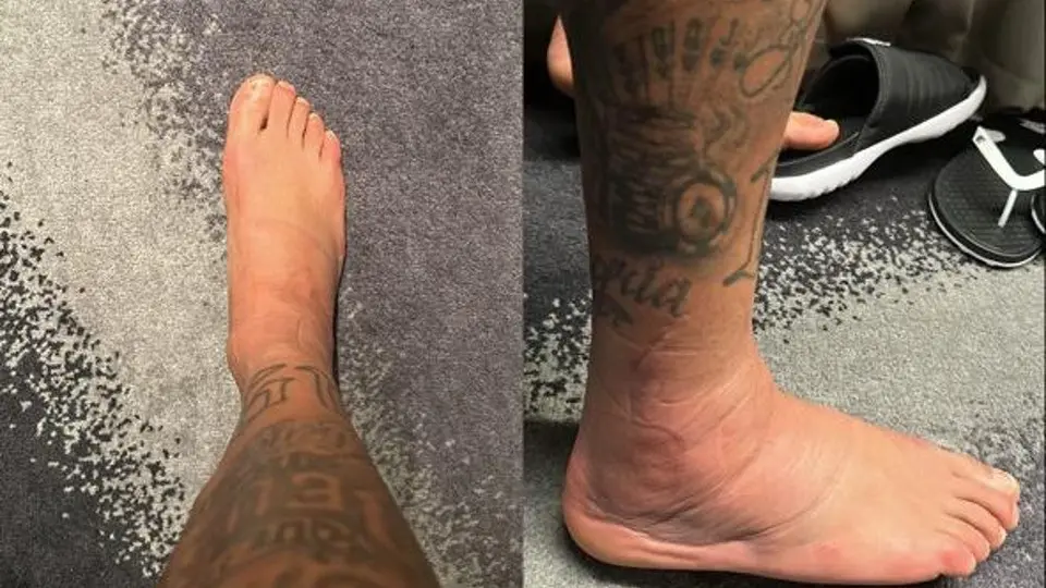 Qatar 2022: Neymar sorprendió con imagen de su tobillo inflamado