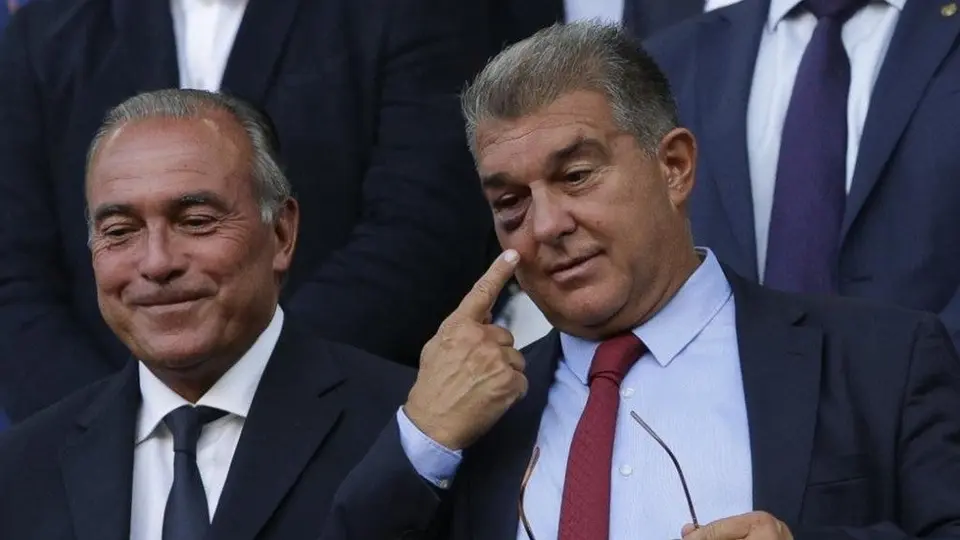 Joan Laporta: Apareció con un ojo morado en Camp Nou