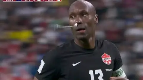 Qatar 2022: Atiba Hutchinson detuvo su hemorragia nasal con tampón