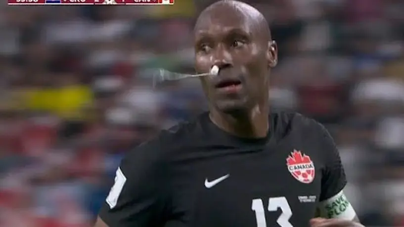 Qatar 2022: Atiba Hutchinson detuvo su hemorragia nasal con tampón