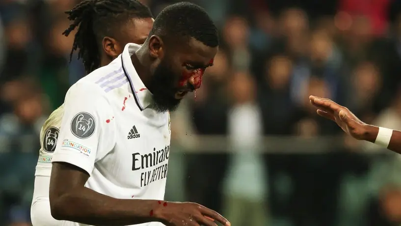 Rüdiger se tomó con 'humor' su golpe: 'Lo que no te mata te hace fuerte, estamos vivos'