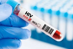 Excluyen a México de acceso a medicamentos genéricos para prevenir el VIH