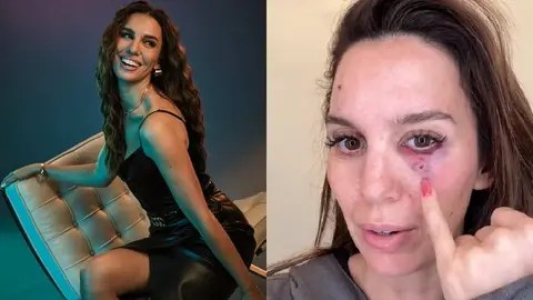 Actriz de Disney recibe disparo en el rostro: “Vi mi vida pasar ante mis ojos”