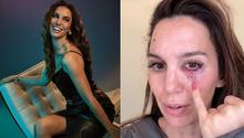Actriz de Disney recibe disparo en el rostro: “Vi mi vida pasar ante mis ojos”