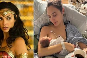Gal Gadot se sometió a una cirugía de emergencia por un coágulo cerebral al mismo tiempo que daba a luz