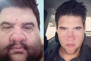 Muere el influencer Gabriel Freitas de un infarto fulminante; había perdido 200 kilos
