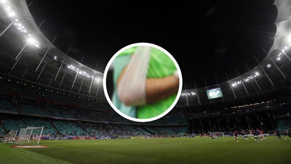 ¡Lamentable! Ronaldo sufre grave lesión que lo dejará varios meses fuera