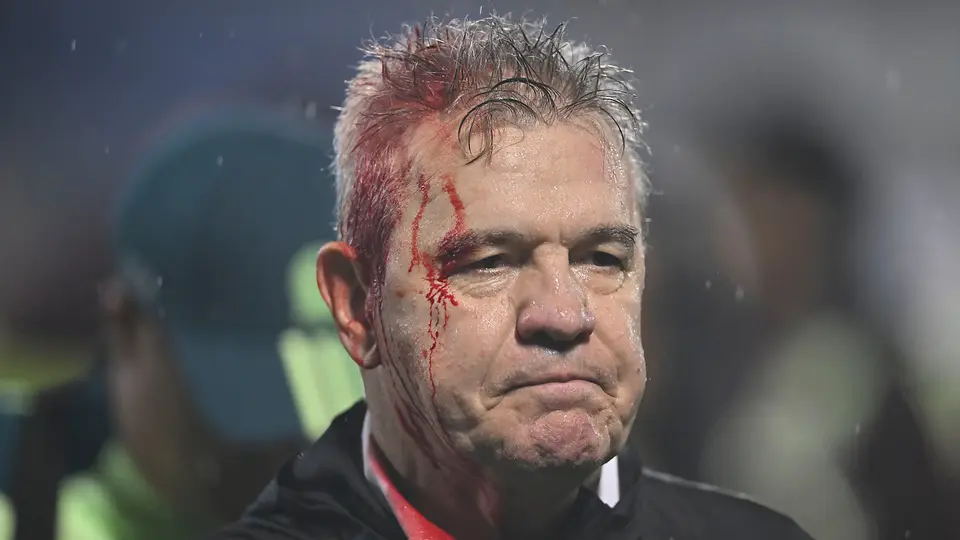 Javier Aguirre con herida en la cabeza en el partido ante Honduras en 2024 | Imago7