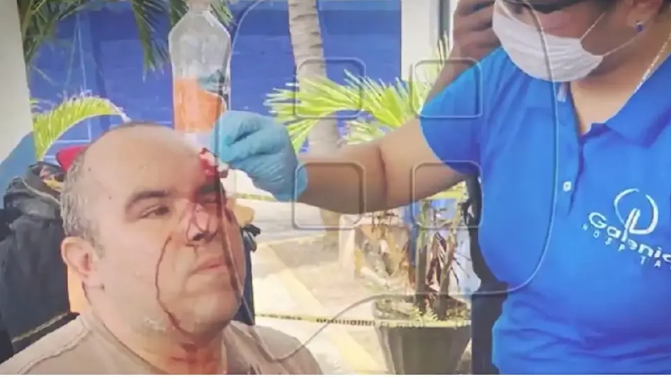 El fotógrafo Ernesto Zepeda denunció a la actriz por robo y violencia / Especial