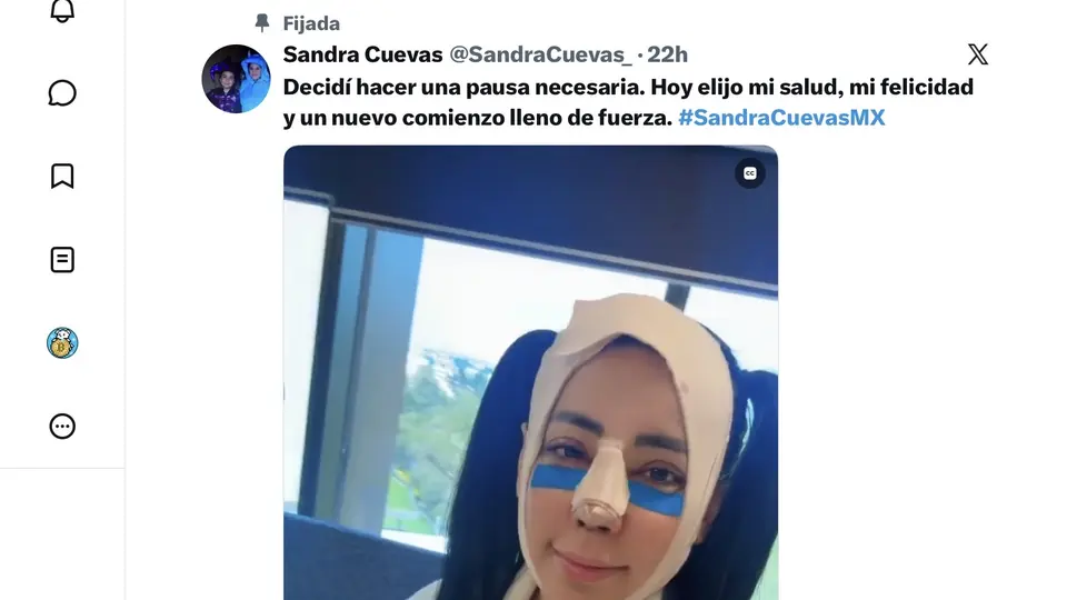 La exalcaldesa aseguró que decidió realizar cambios en su vida para cuidar su salud y buscar una nueva etapa./X:@SandraCuevas_