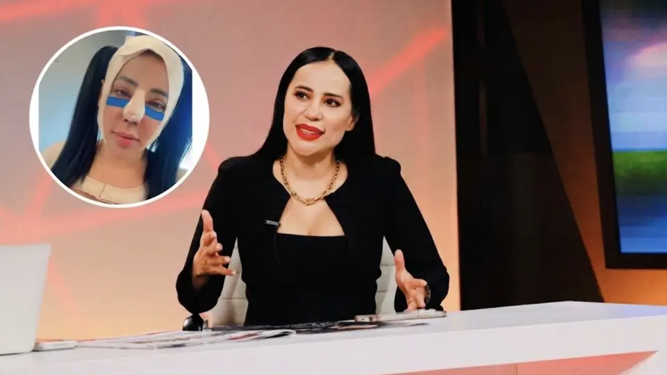 VIDEO: ¿Qué le pasó a Sandra Cuevas? Reaparece con el rostro completamente vendado