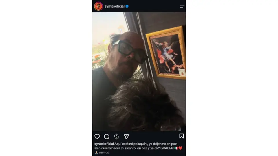“Aquí está mi peluquín, ya déjenme en paz”, escribió el intérprete mexicano al mostrarse por primera vez sin la pieza en redes sociales / Especial