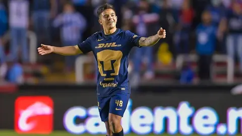 Pumas: Marco García será sometido a operación por la fractura que sufrió en el peroné