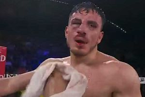 Fotos: Así quedó el rostro del hijo de Julio César Chávez tras derrota con Ortiz