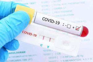 Care Box: El nuevo modelo para la detección de COVID-19