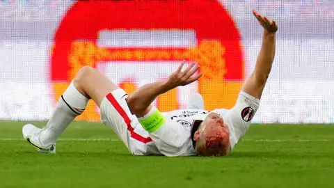 Europa League: Sebastian Rode recibió patada en la cara que le provocó sangrado