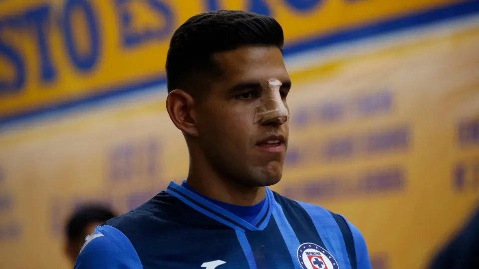 Cruz Azul: Luis Abram fue operado con éxito de la fractura de nariz