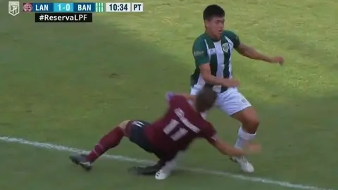 Futbolista recibió balonazo en la cara, cayó sobre la pierna del rival y le provocó fractura