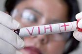 VIH: Médicos de Estados Unidos por primera vez habrían curado a una mujer de SIDA