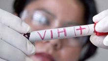 VIH: Médicos de Estados Unidos por primera vez habrían curado a una mujer de SIDA
