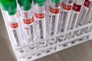 Viruela del mono: López-Gatell confirmó segundo caso detectado en la CDMX