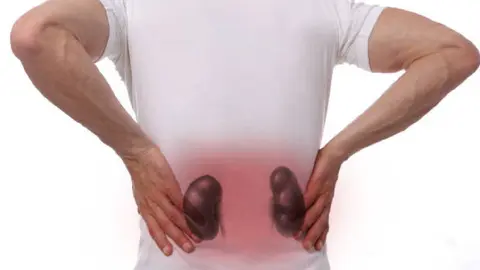 Tationil Plus de 3000 MG es recetado para problemas de insuficiencia renal, que era lo que sufría el Mencho/Pixabay