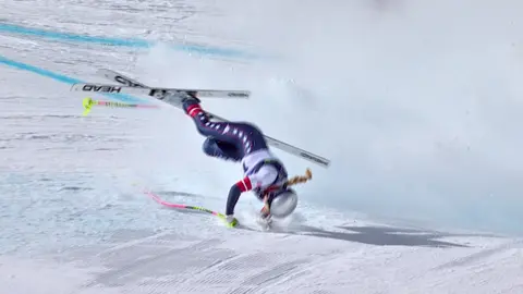 Lindsey Vonn compartió detalles de su lesión | AP