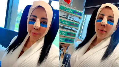 ¿Cuánto costaron las cirugías de Sandra Cuevas? Se operó nariz, papada y párpados