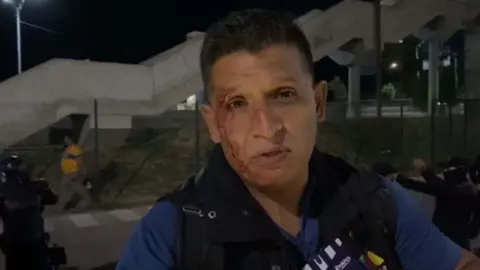 Clásico Regio: Reportero fue golpeado y herido por pseudoaficionados de Tigres