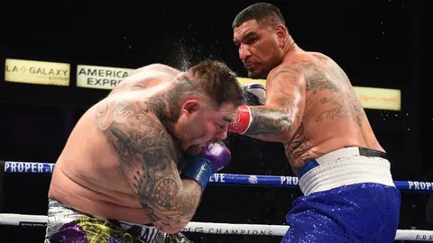 Chris Arreola explotó contra los jueces: 'Sigo feo, pero no estoy tan lastimado'
