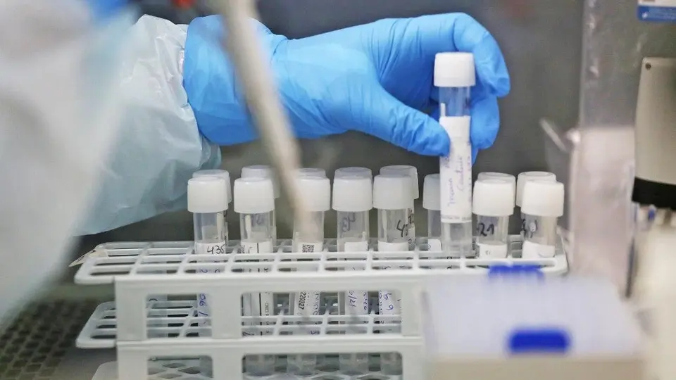 Coronavirus: Hallan 'anticuerpo' capaz de combatir todas las variantes del Covid-19