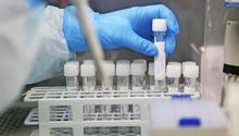 Coronavirus: Hallan 'anticuerpo' capaz de combatir todas las variantes del Covid-19