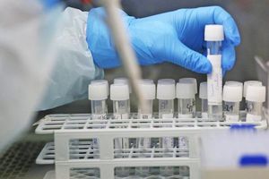 Coronavirus: Hallan 'anticuerpo' capaz de combatir todas las variantes del Covid-19