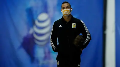 Jesús Dueñas se operó el rostro y quedó 'irreconocible'