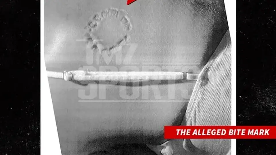 La demandante reveló mordida del receptor de los Ángeles | TMZ