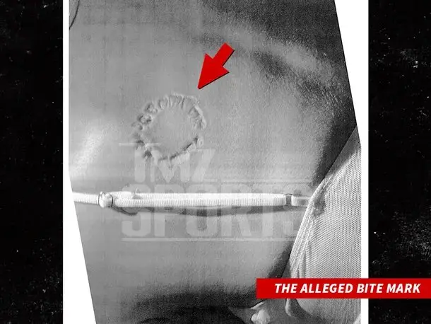 La demandante reveló mordida del receptor de los Ángeles | TMZ