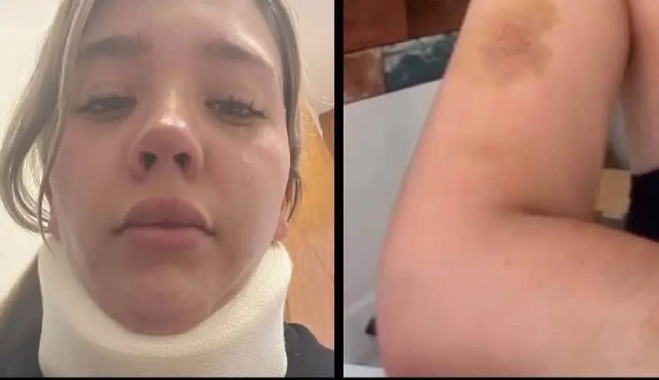 Cielo Moreno muestra parte del ataque que recibió de su padre en Guadalajara / RRSS