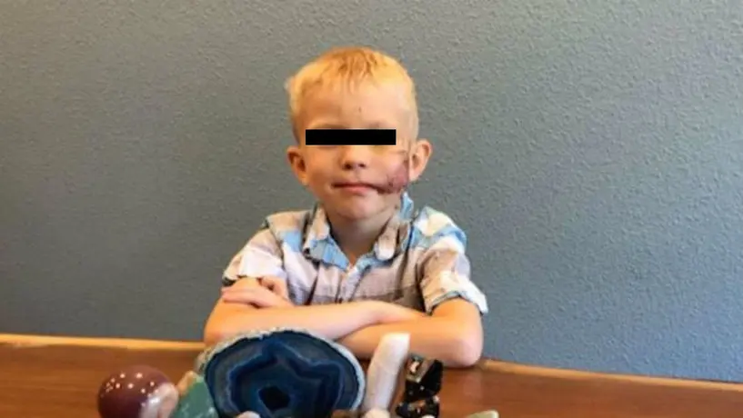 CMB nombró Campeón Honorario a niño que salvó a su hermana del ataque de un perro