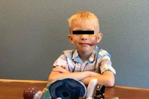 CMB nombró Campeón Honorario a niño que salvó a su hermana del ataque de un perro