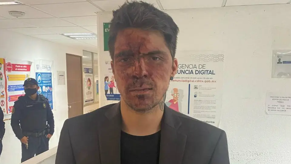 César D’Alessio denunció haber sido golpeado por el hijo del exgobernador Arturo Montiel