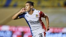 Chivas: El Rebaño apoyará a aficionada que será operada por tumor cerebral