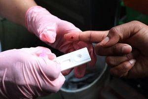 VIH: México participará en ensayo para vacuna contra el SIDA