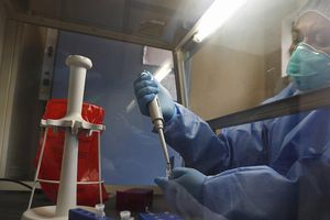 Coronavirus: México pagó anticipo a Covax para obtener vacuna contra Covid-19