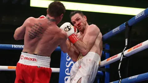Canelo Álvarez: La terrible lesión en el bíceps que sufrió Callum Smith durante pelea vs el mexicano
