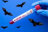 Virus Nipah en India confirman cinco casos cerca de Calcuta hay casi 100 personas en cuarentena