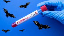 Virus Nipah en India confirman cinco casos cerca de Calcuta hay casi 100 personas en cuarentena