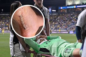 “Sólo Dios sabe por qué”: Luis Ángel Malagón muestra el resultado de su operación