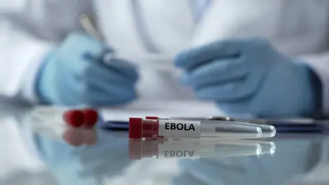 Expertos alertan que la cepa actual de ébola no cuenta con vacuna aprobada ni tratamiento específico. / iStock